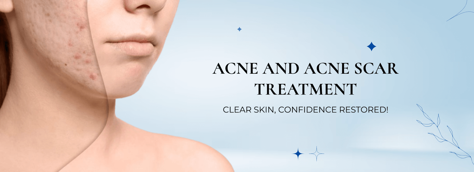 ACNE AND ACNE SCAR