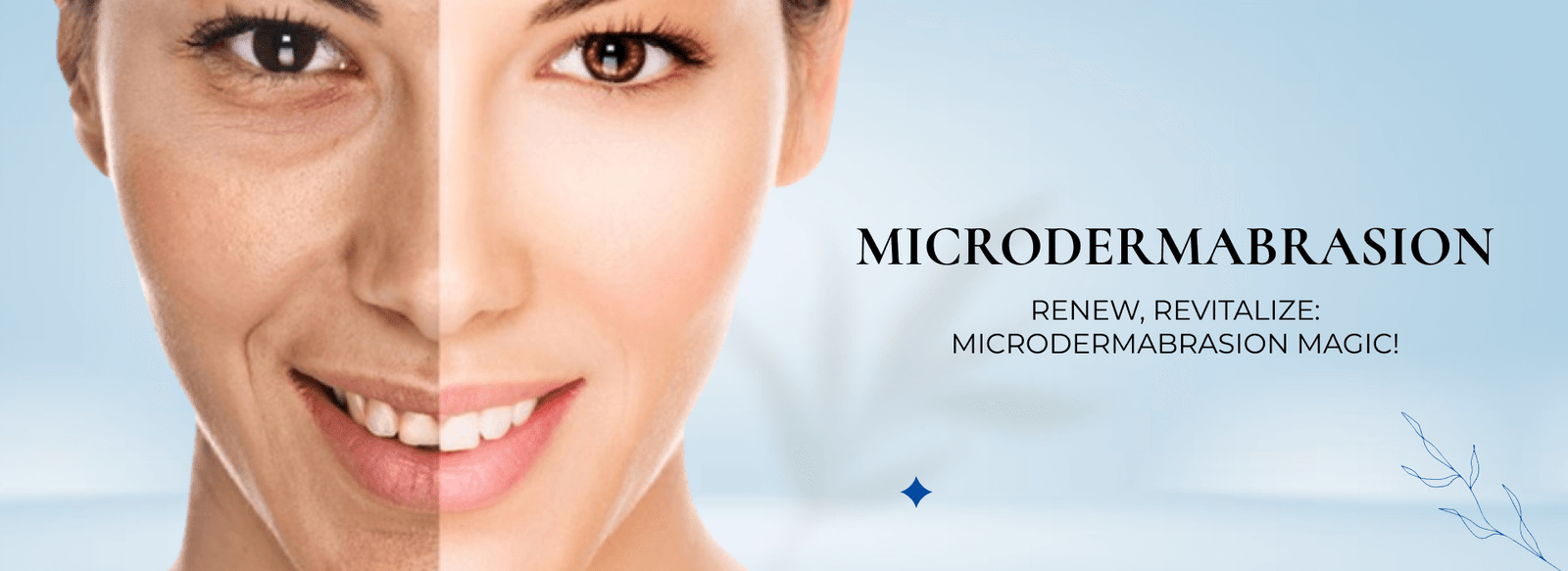 Microdermabrasion
